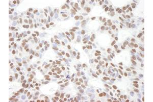 Immunohistochemistry (IHC) image for anti-B-Cell CLL/lymphoma 11B (Zinc Finger Protein) (BCL11B) (C-Term) antibody (ABIN7448431) (BCL11B anticorps  (C-Term))