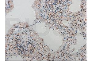 Formalin-fixed and paraffin-embedded rat aortic tissue labeled with Rabbit Anti-NFKB p65 Polyclonal Antibody (ABIN668961), Unconjugated at 1:600 followed by conjugation to the secondary antibody and DAB staining (NF-kB p65 anticorps  (AA 51-100))