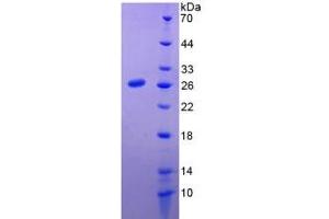SDS-PAGE of Protein Standard from the Kit (Highly purified E. (Prolactin Kit CLIA)