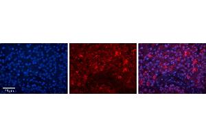 Rabbit Anti-ILF3 Antibody     Formalin Fixed Paraffin Embedded Tissue: Human Pineal Tissue  Observed Staining: Cytoplasmic and nuclear in pinealocytes  Primary Antibody Concentration: 1:100  Other Working Concentrations: 1/600  Secondary Antibody: Donkey anti-Rabbit-Cy3  Secondary Antibody Concentration: 1:200  Magnification: 20X  Exposure Time: 0. (Interleukin enhancer-binding factor 3 (ILF3) (N-Term) anticorps)