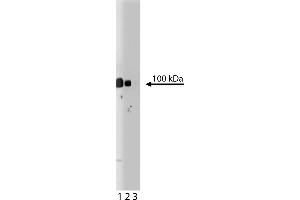 Western Blotting (WB) image for anti-Plakophilin 2 (PKP2) (AA 19-183) antibody (ABIN968178)