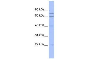 ZNF431 antibody used at 0. (ZNF431 anticorps  (Middle Region))
