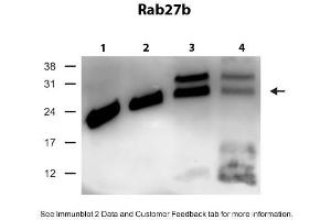 WB Suggested Anti-Rab27b Antibody Titration: 0. (RAB27B anticorps  (C-Term))