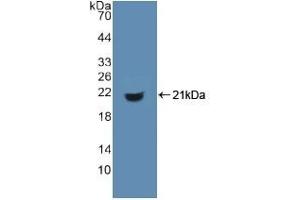 Detection of Recombinant MHCDG, Human using Polyclonal Antibody to Cluster Of Differentiation 74 (CD74) (CD74 anticorps  (AA 64-205))