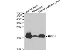 Western blot analysis of extracts of various cell lines, using TNNC1 antibody. (TNNC1 anticorps  (AA 1-160))