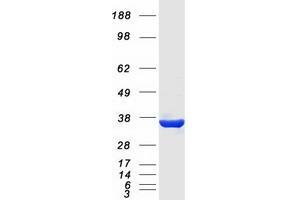 Validation with Western Blot