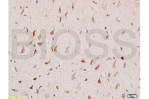 Formalin-fixed and paraffin embedded: rat brain tissue labeled with Anti-CNP/CNPase Polyclonal Antibody (ABIN730738), Unconjugated at 1:200, followed by conjugation to the secondary antibody and DAB staining (Cnpase anticorps  (AA 151-250))
