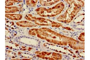 Immunohistochemistry of paraffin-embedded human kidney tissue using ABIN7163258 at dilution of 1:100 (PCK1 anticorps  (AA 1-622))