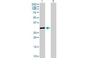 Western Blot analysis of SALL2 expression in transfected 293T cell line by SALL2 MaxPab polyclonal antibody.