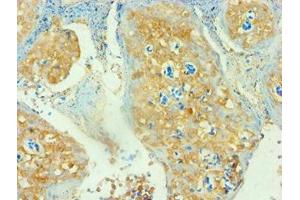 Immunohistochemistry of paraffin-embedded human tonsil tissue using ABIN7171381 at dilution of 1: 100 (CD3D anticorps  (AA 22-105))