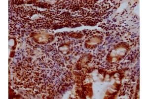 IHC image of ABIN7127591 diluted at 1:100 and staining in paraffin-embedded human small intestine tissue performed on a Leica BondTM system.