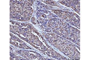 IHC analysis of ADH1A using anti-ADH1A antibody (ABIN4886427). (ADH1A anticorps  (AA 213-375))