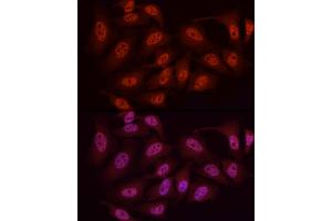Immunofluorescence analysis of HeLa cells using WTAP Rabbit pAb (ABIN7271372) at dilution of 1:50 (40x lens). (WTAP anticorps  (AA 1-396))