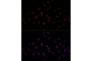 Immunofluorescence analysis of U-2 OS cells using BRC antibody (1318) at dilution of 1:100. (BRCA1 anticorps  (AA 400-699))