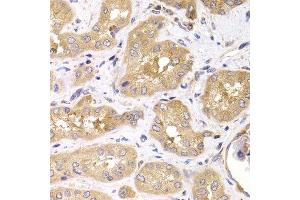 Immunohistochemistry of paraffin-embedded human kidney using RPS4X antibody.