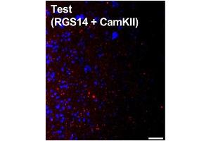 Coronal section from a C57BL/6J mouse CA2 hippocampus showing duolink staining where signal (red) denotes interaction between two proteins targeted with primary antibodies RGS14 (cat.
