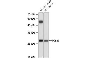 Western blot analysis of extracts of various cell lines, using FGF23 antibody (ABIN6127894, ABIN6140600, ABIN6140602 and ABIN6221721) at 1:500 dilution. (FGF23 anticorps  (AA 25-251))