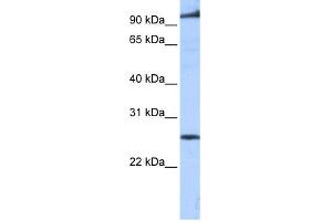 WB Suggested Anti-PPAPDC1B Antibody Titration:  0. (PPAPDC1B anticorps  (Middle Region))