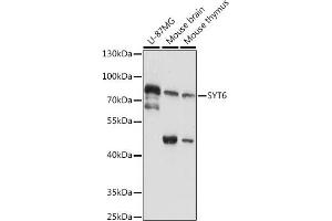 Western blot analysis of extracts of various cell lines, using SYT6 antibody (ABIN7270677) at 1:1000 dilution. (SYT6 anticorps  (AA 1-120))