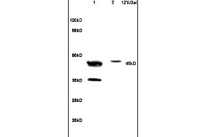 Lane 1: human colon carcinoma lysates Lane 2: mouse brain lysates probed with Anti NCF1/p47 phox Polyclonal Antibody, Unconjugated (ABIN750643) at 1:200 in 4 °C.