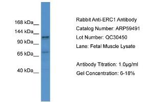 WB Suggested Anti-ERC1  Antibody Titration: 0. (ERC1 anticorps  (C-Term))