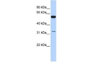 WB Suggested Anti-DDX28 Antibody Titration:  0. (DDX28 anticorps  (N-Term))
