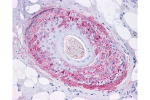 Anti-Ghrelin Receptor antibody IHC of human skin, hair follicle.