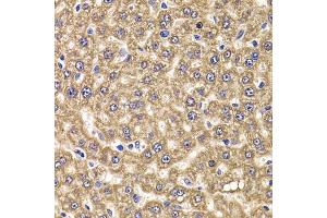 Immunohistochemistry of paraffin-embedded rat liver using UBE2J2 antibody (ABIN5974418) at dilution of 1/100 (40x lens). (UBE2J2 anticorps)