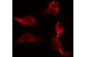 ABIN6278357 staining Hela by IF/ICC. (CARD9 anticorps  (C-Term))