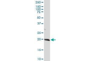 anti-Anaphase Promoting Complex Subunit 10 (ANAPC10) (AA 1-185) antibody