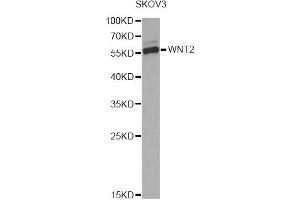 Western blot analysis of extracts of SKOV3 cells, using WNT2 Antibody. (WNT2 anticorps)