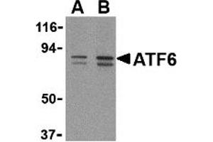 Western Blotting (WB) image for anti-Activating Transcription Factor 6 (ATF6) (C-Term) antibody (ABIN1030261) (ATF6 anticorps  (C-Term))