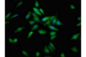 Immunofluorescent analysis of Hela cells using ABIN7149308 at dilution of 1:100 and Alexa Fluor 488-congugated AffiniPure Goat Anti-Rabbit IgG(H+L)