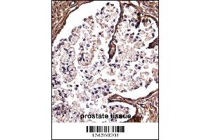 DSG2 Antibody immunohistochemistry analysis in formalin fixed and paraffin embedded human prostate tissue followed by peroxidase conjugation of the secondary antibody and DAB staining.