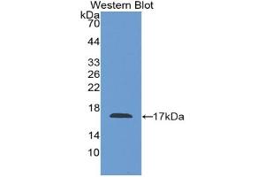 Western blot analysis of the recombinant protein. (Factor VIII anticorps  (AA 1854-1989))