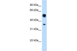 Western Blotting (WB) image for anti-Argininosuccinate Lyase (ASL) antibody (ABIN2462447) (ASL anticorps)