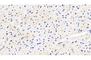 Detection of PLOD1 in Human Cardiac Muscle Tissue using Polyclonal Antibody to Procollagen Lysine-1,2-Oxoglutarate-5-Dioxygenase 1 (PLOD1) (PLOD1 anticorps  (AA 636-727))