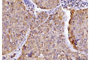 IHC analysis of AHA1/AHSA1 using anti-AHA1/AHSA1 antibody (ABIN7600708). (AHSA1 anticorps  (AA 221-264))