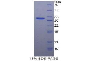 SDS-PAGE analysis of Human Connexin 37 Protein. (GJA4 Protéine)
