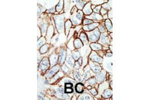 Immunohistochemistry (IHC) image for anti-Histone Deacetylase 11 (HDAC11) antibody (ABIN2996030) (HDAC11 anticorps)