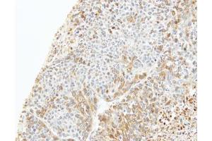 anti-Capping Protein (Actin Filament) Muscle Z-Line, beta (CAPZB) (Center) antibody