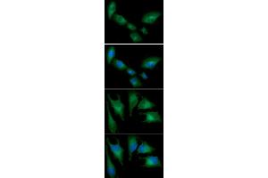 ICC/IF analysis of HMOX in A549 cells line, stained with DAPI (Blue) for nucleus staining and monoclonal anti-human HMOX antibody (1:100) with goat anti-mouse IgG-Alexa fluor 488 conjugate (Green) ICC/IF analysis of HMOX in HeLa cells line, stained with DAPI (Blue) for nucleus staining and monoclonal anti-human HMOX antibody (1:100) with goat anti-mouse IgG-Alexa fluor 488 conjugate (Green)