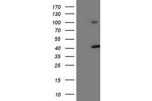 Western Blotting (WB) image for anti-Proteasome (Prosome, Macropain) 26S Subunit, Non-ATPase, 2 (PSMD2) antibody (ABIN1500479) (PSMD2 anticorps)