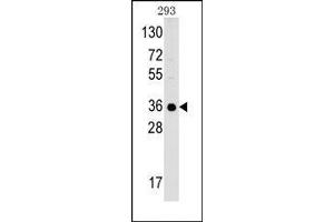 Image no. 1 for anti-Complement Component 1, Q Subcomponent Binding Protein (C1QBP) (C-Term) antibody (ABIN360188) (C1QBP anticorps  (C-Term))