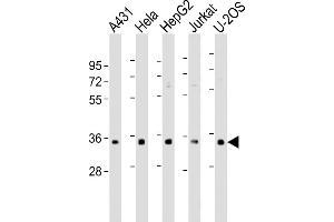 All lanes : Anti-RNPS1 Antibody (N-Term) at 1:500-1:1000 dilution Lane 1: A431 whole cell lysate Lane 2: Hela whole cell lysate Lane 3: HepG2 whole cell lysate Lane 4: Jurkat whole cell lysate Lane 5: U-2OS whole cell lysate Lysates/proteins at 20 μg per lane. (RNPS1 anticorps  (AA 11-44))