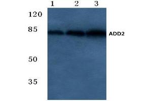 Western blot analysis of Beta-Adducin Antibody at 1/500 dilution.