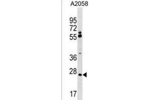 CNPY3 Antibody (N-term) (ABIN1539523 and ABIN2850084) western blot analysis in  cell line lysates (35 μg/lane). (TNRC5 anticorps  (N-Term))