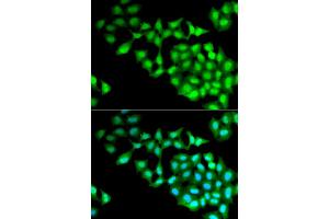 Immunofluorescence analysis of MCF-7 cell using RNGTT antibody. (RNGTT anticorps)