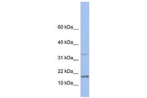 TCL1A antibody used at 1 ug/ml to detect target protein. (TCL1A anticorps  (N-Term))