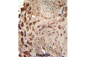 Immunohistochemistry (IHC) image for anti-Protein Kinase, Interferon-Inducible Double Stranded RNA Dependent Activator (PRKRA) antibody (ABIN3003466)